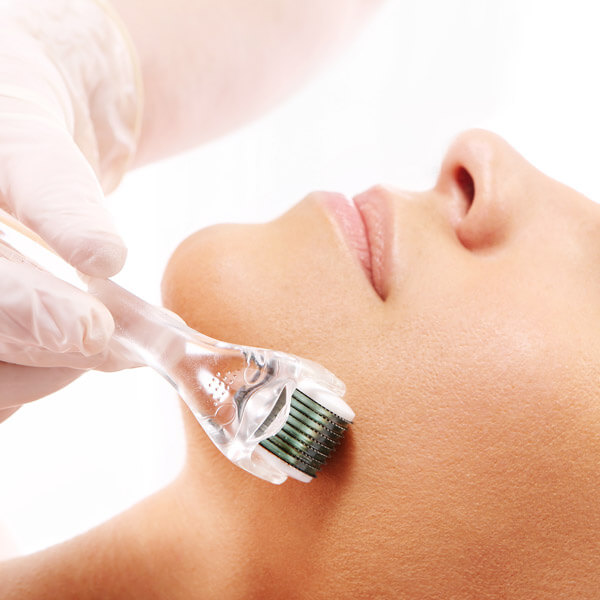 Micro Needling