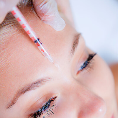 Fillers / Juvederm / Restylane